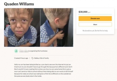 Scammers target bullied boy with dwarfism by setting up fake fundraisers