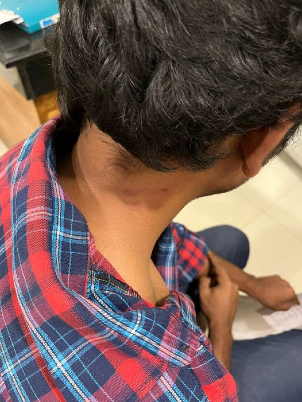 Youth Assaulted by Private Bus Gang After Questioning Delay in Departure